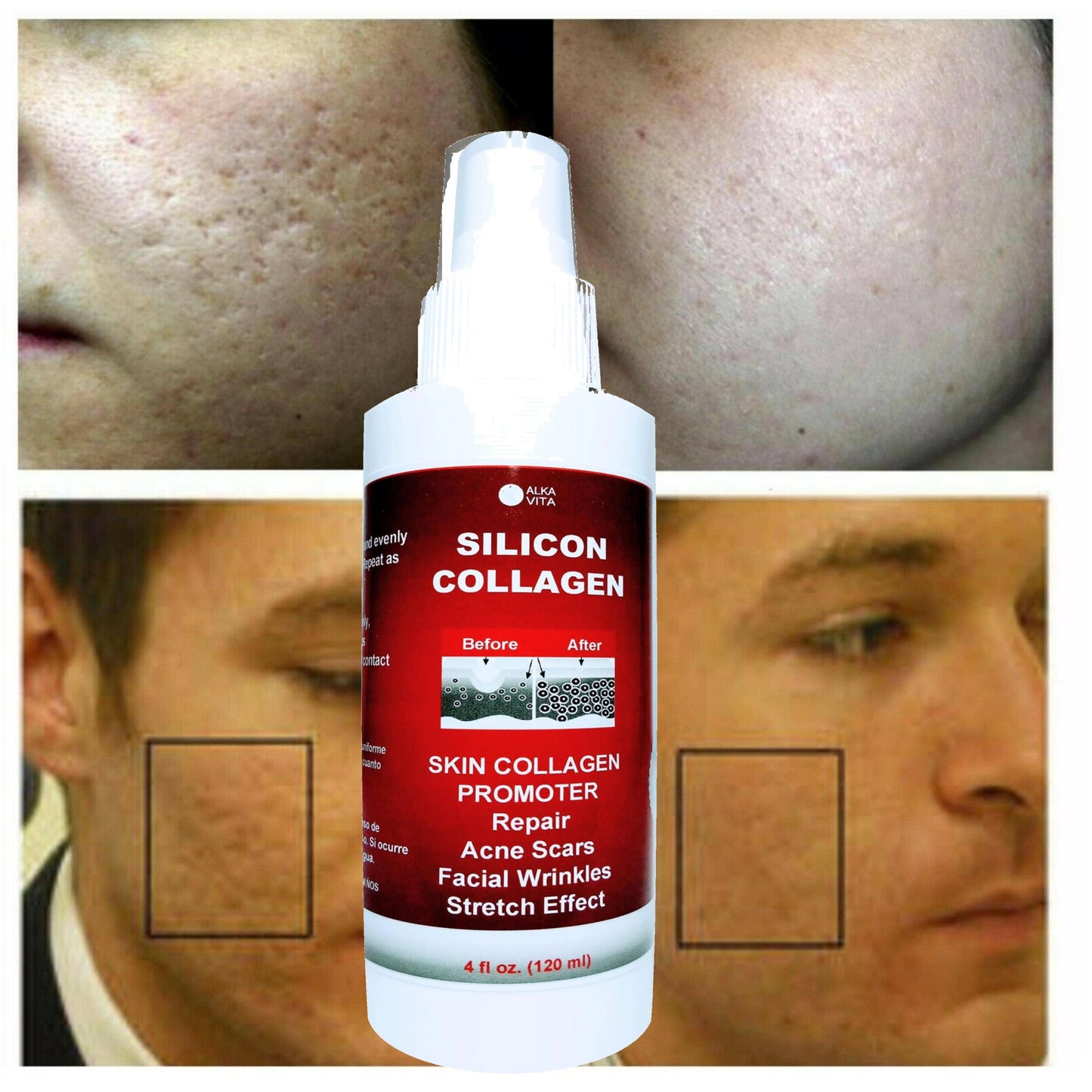 SILICON & COLLAGEN Spray | Skin Face Wrinkle Stretching Effect | 4oz