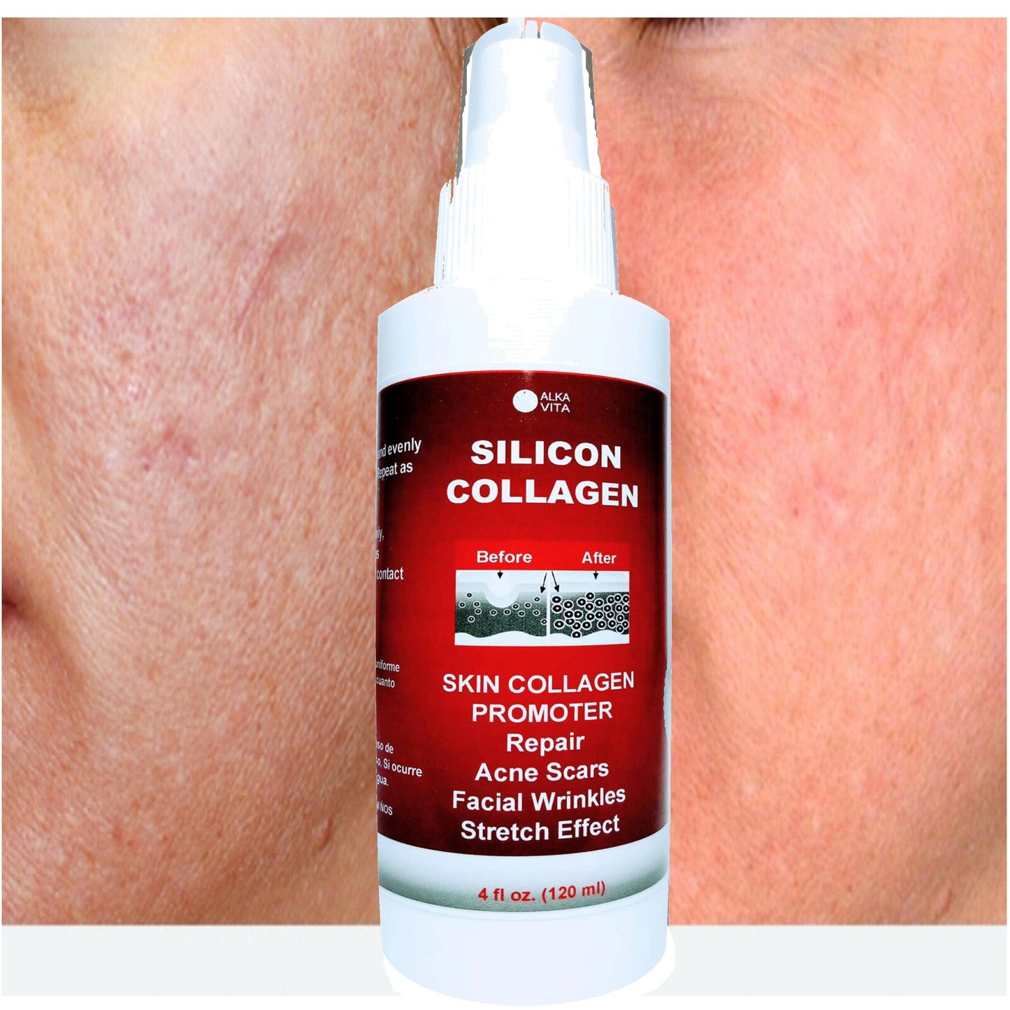 SILICON & COLLAGEN Spray | Skin Face Wrinkle Stretching Effect | 4oz